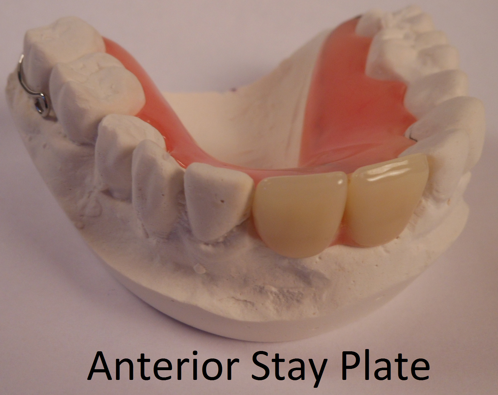 Ant_stayplate.png