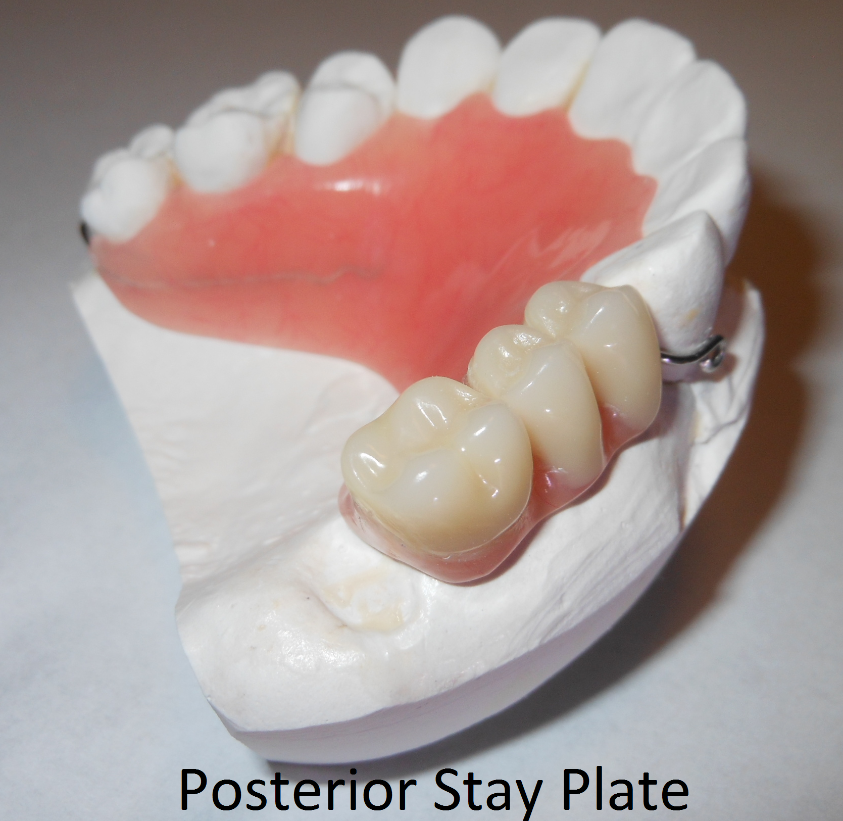 pos_stayplate.png